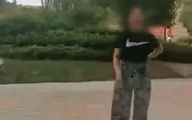 Chó cưng cắn trẻ hàng xóm, người chủ không nhận lỗi còn phản ứng gây gổ Ảnh 2