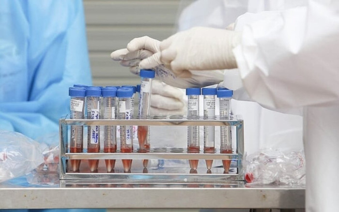 Giấy chứng nhận xét nghiệm âm tính có giá trị trong bao nhiêu ngày? Ảnh 2