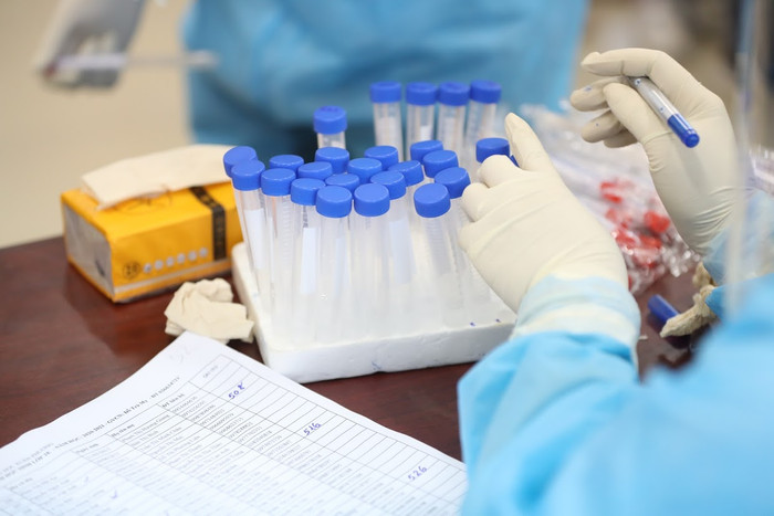 Tất cả các trường hợp từ vùng có dịch về phải tổ chức xét nghiệm 3 lần. (Ảnh minh hoạ).