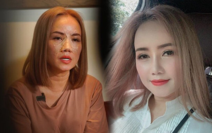 'Cô Xuyến' Hoàng Yến khoe nhan sắc đã hồi phục xinh đẹp sau khi bị chồng cũ đấm vỡ mũi Ảnh 2