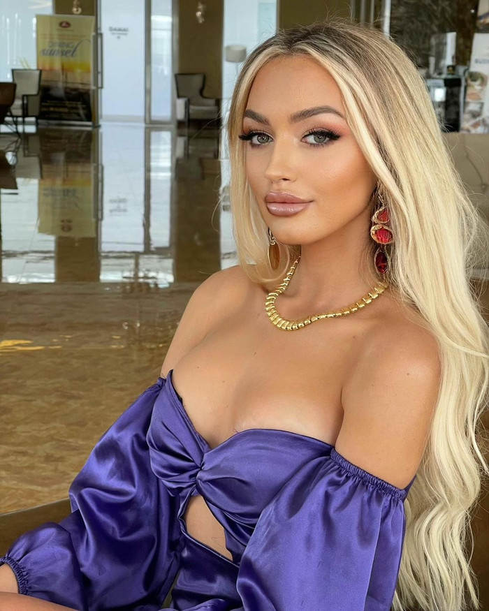 Nhan sắc nóng bỏng của đại diện Kosovo tại Miss Universe 2021: Body Kim Duyên liệu có lép vế? Ảnh 3