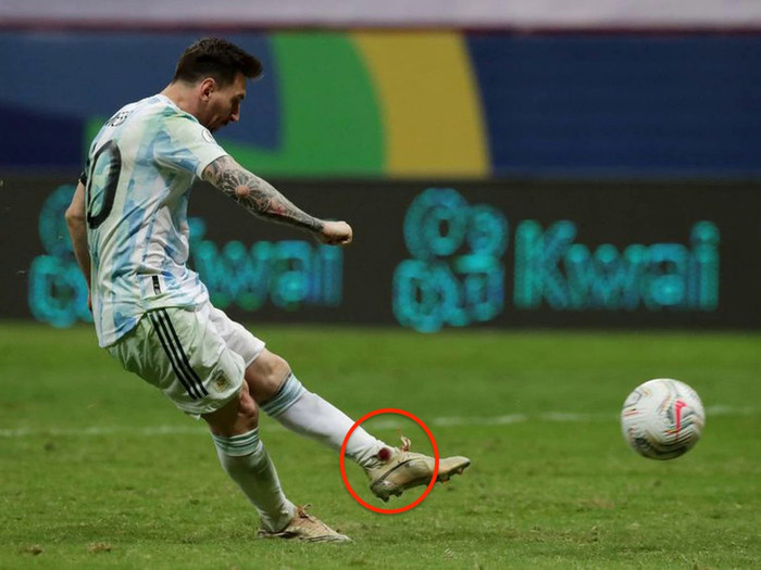 Messi đổ máu tại Copa America 2021, thi đấu thăng hoa đưa Argentina vào chung kết.