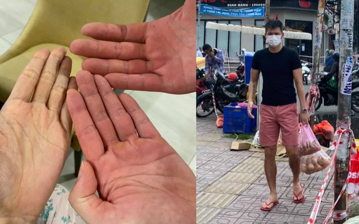 Công Vinh khoe bàn tay đỏ lòm vì phụ Thủy Tiên đi hỗ trợ vùng dịch, nào ngờ vẫn bị mỉa mai Ảnh 2