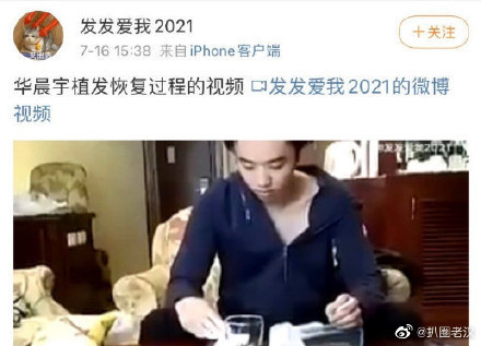 Video Hoa Thần Vũ trong quá trình cấy tóc hồi phục