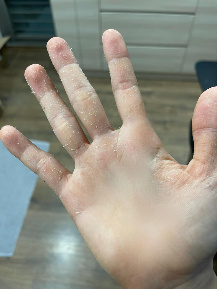 Á hậu 1 Hoa hậu Việt Nam 2010 - Vũ Thị Hoàng My là một trong những nghệ sĩ tích cực tham gia công tác điều phối, lấy mẫu xét nghiệm. Mỗi ngày, nàng Hậu đã phải liên tục rửa tay sát khuẩn, thay găng tay và làm việc với cường độ cao, chính điều này đã khiến đôi bàn tay của Hoàng My bị bong tróc.