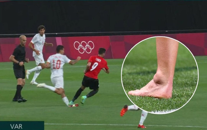 Cầu thủ Tây Ban Nha chấn thương kinh hoàng, cổ chân bị bẻ gập Ảnh 2