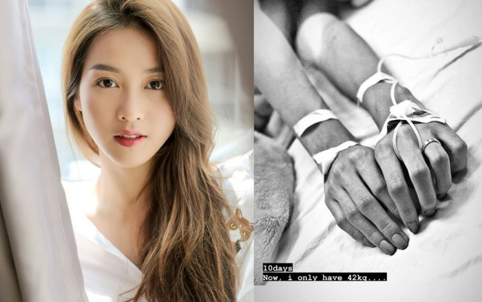 Khả Ngân gây hoang mang khi tiết lộ ho ra máu, tay chằng chịt kim tiêm, sút cân trầm trọng Ảnh 2