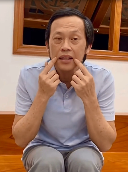 NS Hoài Linh gương mặt hồng hào thấy rõ.