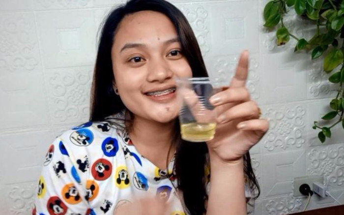 Ở nhà ngày dịch, hot blogger dùng... nước tiểu trị mụn khiến dân tình hoảng hốt Ảnh 2