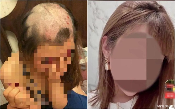 Vợ bị chồng cạo trọc đầu, nguyên nhân khiến dân mạng dậy sóng xót xa Ảnh 2
