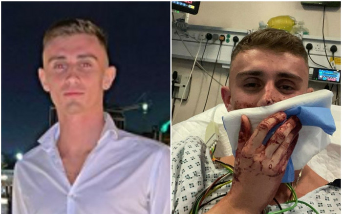 Võ sĩ taekwondo vừa dự Olympic bị hành hung rách mặt, phải vào viện phẫu thuật Ảnh 2