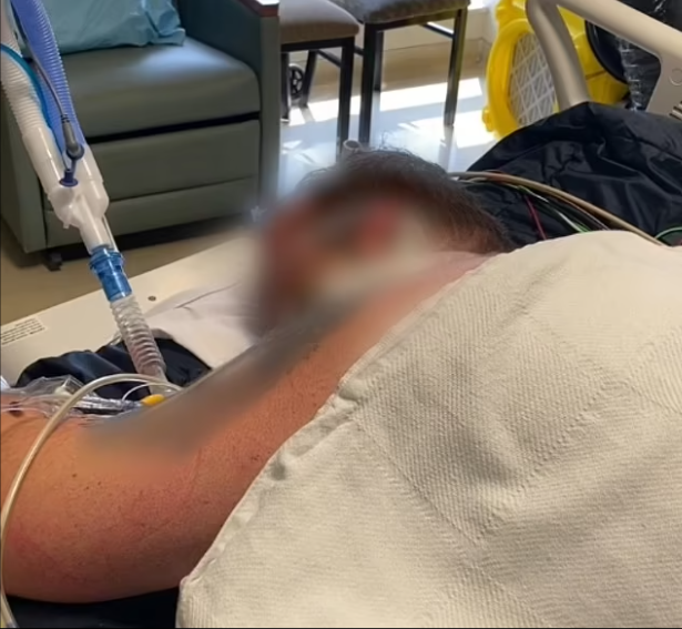 Bác sĩ chia sẻ hình ảnh đau lòng về các bệnh nhân Covid-19 trong phòng điều trị tích cực Ảnh 3