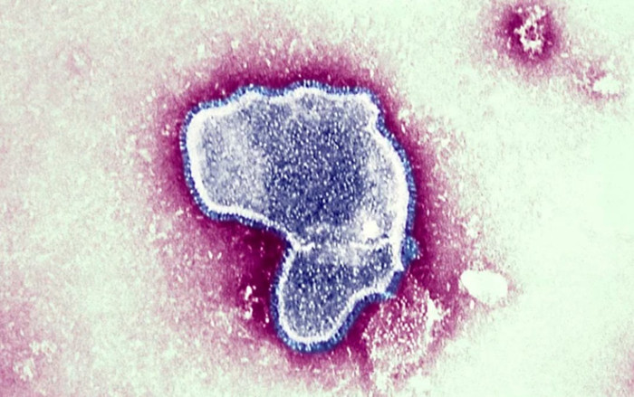 Thêm loại virus xuất hiện cùng lúc ở bệnh nhân nhí mắc Covid-19, khiến tỷ lệ nhập viện tăng Ảnh 2