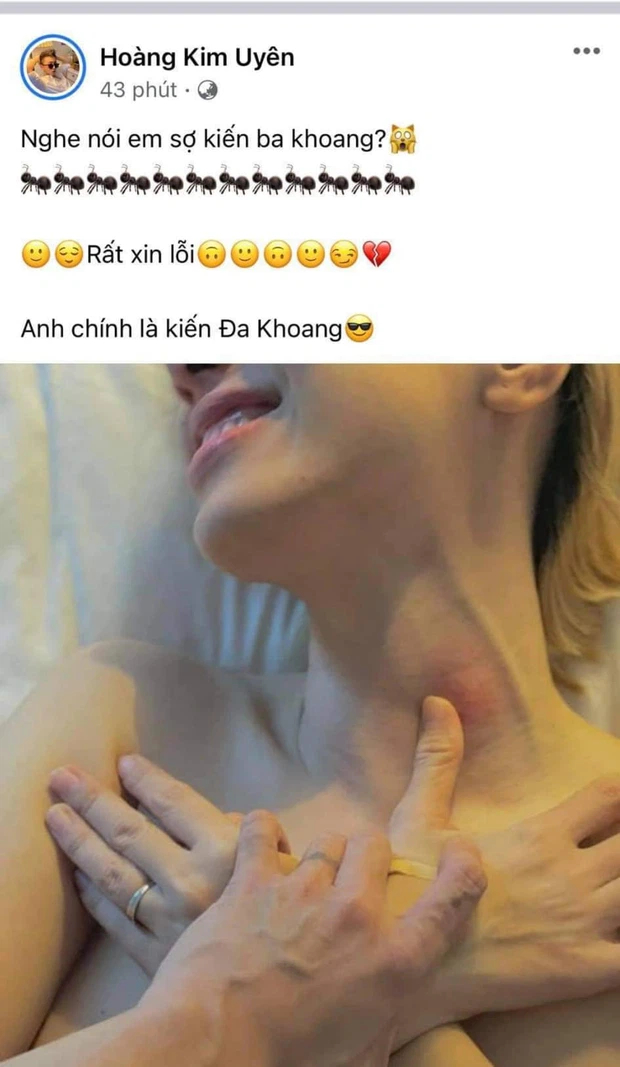 Bạn trai chuyển giới của Miko Lan Trinh đặt bàn tay lên 'điểm nhạy cảm' trên cơ thể của bạn gái. 