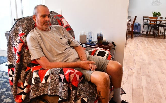 Nằm viện 221 ngày, thở máy 165 ngày, người đàn ông vẫn chiến thắng Covid-19 Ảnh 2