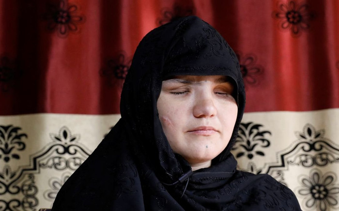 Ám ảnh lời kể của người phụ nữ bị Taliban khoét mắt, bắn 8 phát súng vào người Ảnh 2