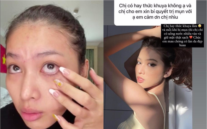 Rũ bỏ son phấn, Á hậu Ngọc Thảo lộ da mặt chi chít mụn, mắt thâm quầng Ảnh 2