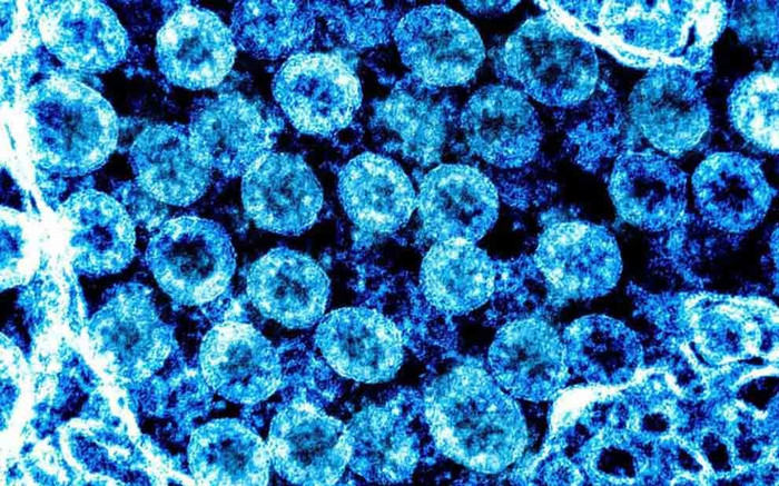 Nghiên cứu mới: Virus SARS-CoV-2 có thể thay đổi hình dạng để cải thiện khả năng sống sót Ảnh 2