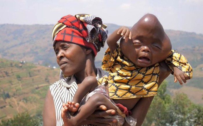 Vợ sinh con dị dạng, người cha hèn hạ nói câu tàn độc Ảnh 2