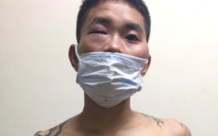 Nam thanh niên 'ngáo đá' không đeo khẩu trang, ra chốt túm tóc cán bộ đòi xe máy vi phạm Ảnh 2