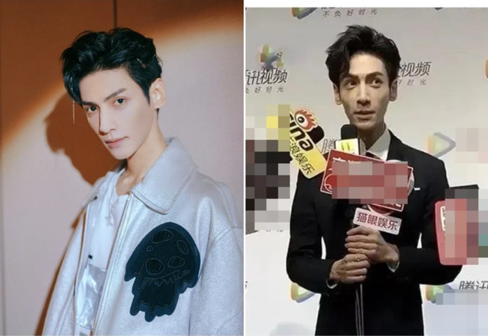 La Vân Hi ốm tong teo 'ngồi xe lăn' như bị quần áo nuốt chửng, còn đâu nam thần cổ trang vạn người mê Ảnh 4