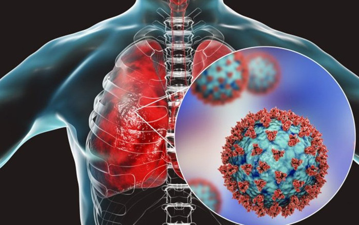 Phát hiện mới về lượng virus SARS-CoV-2 trong phổi gây tử vong ở bệnh nhân Covid-19 Ảnh 2