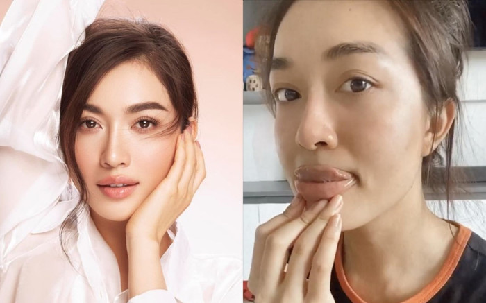 Á hậu Lệ Hằng khiến fan hết hồn với đôi môi sưng vù, cong tớn như dao kéo hỏng Ảnh 2