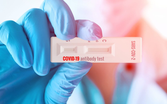 Có cần thiết xét nghiệm kháng thể sau khi tiêm vaccine Covid-19? Ảnh 2