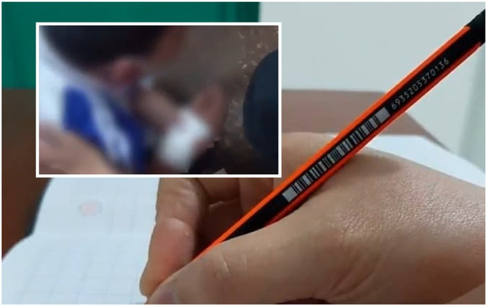 Học sinh tiểu học viết chữ xấu bị cô giáo rạch tay gây chấn động Trung Quốc Ảnh 2