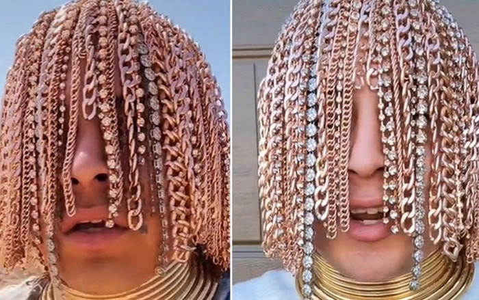 Nam rapper 'chơi trội' cấy tóc bằng… dây chuyền vàng, răng nạm kim cương Ảnh 2