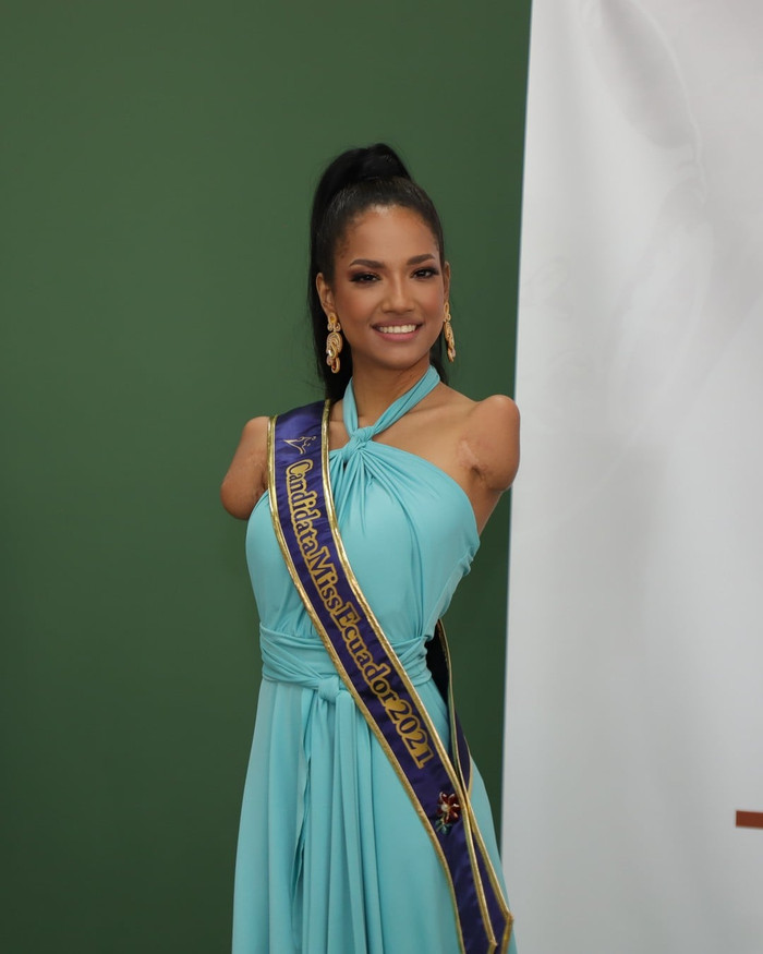 Câu chuyện cảm động về mỹ nữ khuyết tật và hành trình gian nan đến với Miss Universe Ảnh 8