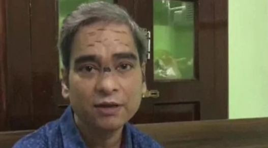 Anh Vishwas Saini đã chiến đấu với Covid-19 suốt 130 ngày. 