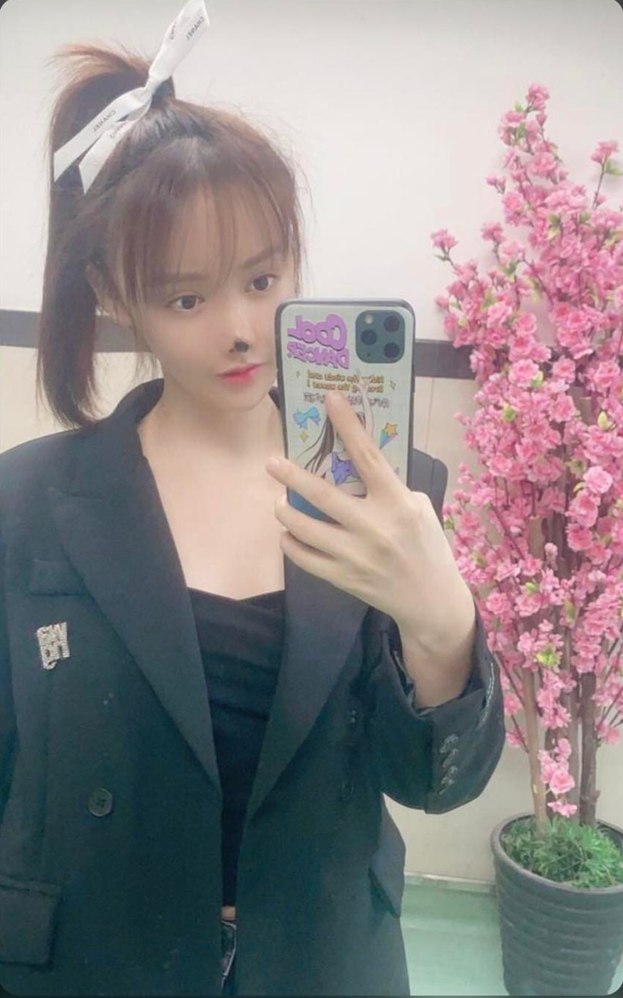 Gưong mặt biến dạng khiến Cao Lưu phải huỷ hợp đồng với 2 bộ phim đã đa đang chuẩn bị khởi quay, cũng như đối mặt với khoản tiền bồi thường thiệt hại là 2 triệu tệ (7 tỷ đồng).