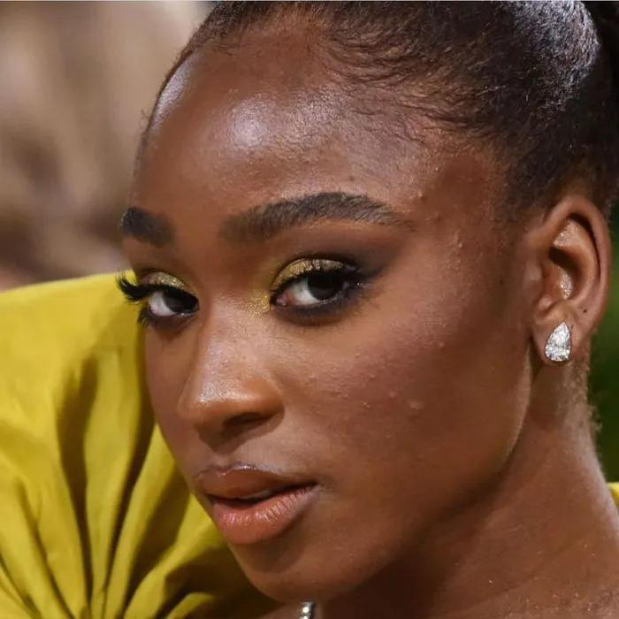 Trong khi đó, làn da với nhiều mụn bọc của Nomarni lại khiến nhiều người 'phát hoảng'. 