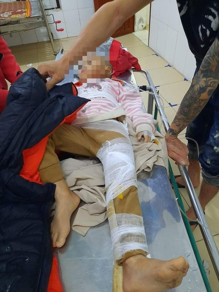 Một cháu bị gãy chân