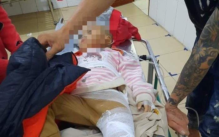 Sạt lở núi làm sập nhà dân, 1 cháu nhỏ bị gãy xương cổ đùi Ảnh 2