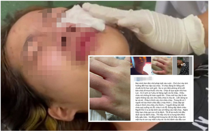 Xót xa lời cầu cứu của người mẹ vụ nữ sinh bị nhóm nam thanh niên hành hung, xịt hơi cay vào mắt Ảnh 2