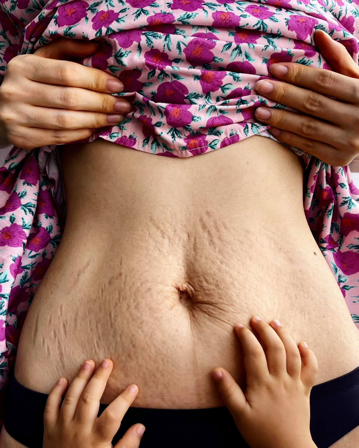 Hình ảnh sau 2 năm.