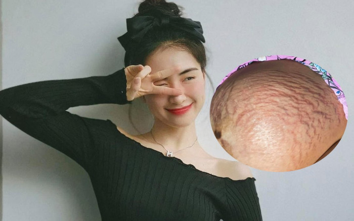 Hòa Minzy lần đầu chia sẻ hình ảnh rạn da khi mang thai, netizen xúc động: 'Thương lắm những người mẹ' Ảnh 2