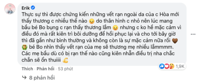 Gia đình 'Hoa Dâm Bụt' và loạt sao Việt lên tiếng khi Hòa Minzy khoe ảnh rạn da sau sinh bé Bo Ảnh 4