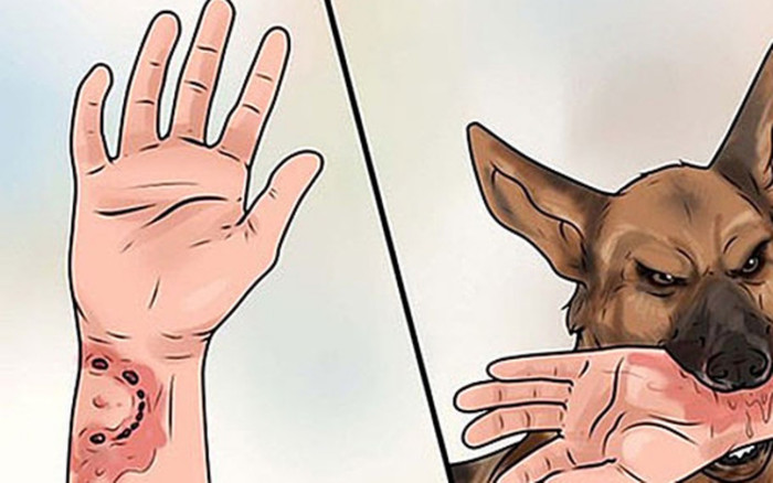 Liên tiếp ghi nhận nhiều trường hợp trẻ tử vong vì bệnh dại do không được điều trị kịp thời Ảnh 2