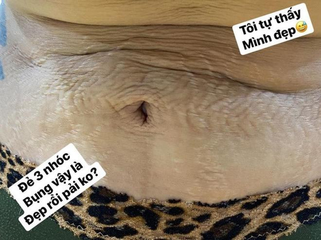 Tuy nhiên, người đẹp vẫn không tránh khỏi những vết rạn cùng phần da nhăn nheo, bị chùng xuống rõ rệt. Dù như thế, giọng ca 'Viên đá nhỏ' vẫn rất yêu cơ thể chính mình, trân trọng từng khiếm khuyết riêng. 