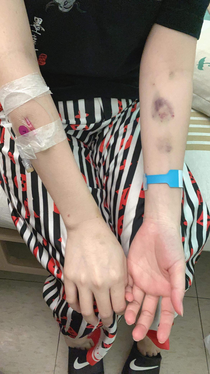 Cơ thể cố bắt đầu xuất hiện những triệu chứng khi bắt đầu phát hiện ra bệnh.