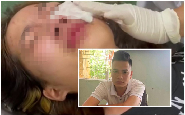 Lộ diện thanh niên xịt bình hơi cay vào mặt nữ sinh lớp 10 ở Hải Phòng sau cuộc trêu ghẹo Ảnh 2