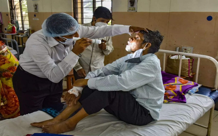 Gặp biến chứng sau khi nhiễm Covid-19, người đàn ông phải đánh đổi bằng 1 quả thận và 1 phần phổi Ảnh 2