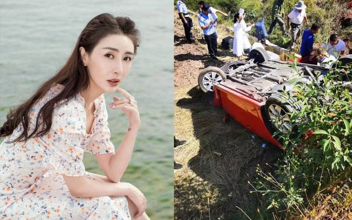 Nữ diễn viên Tân Thủy Hử gặp tai nạn nghiêm trọng, phải khâu 54 mũi Ảnh 2