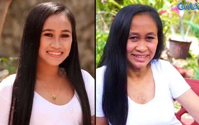 Thiếu nữ 16 tuổi xinh đẹp biến thành bà lão sau 2 năm Ảnh 2