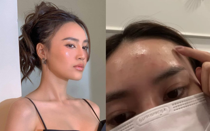 Ninh Dương Lan Ngọc lộ mặt chi chít mụn, không dám khoe cận nhan sắc trước ống kính Ảnh 2