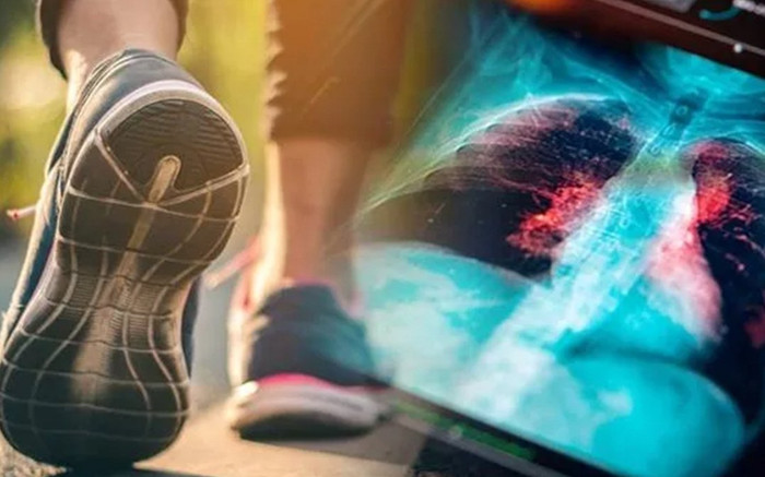 Dấu hiệu cảnh báo ung thư phổi ngay từ cách đi bộ Ảnh 2