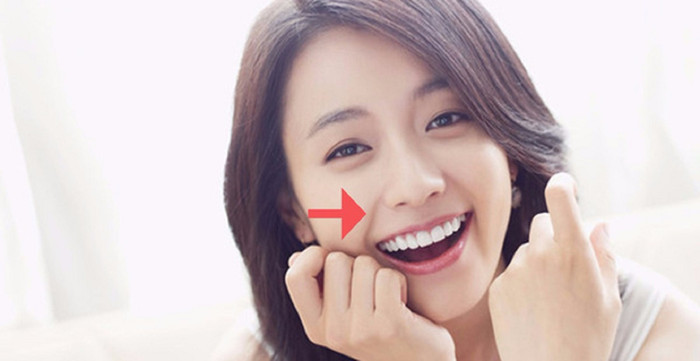 Đường râu rồng thường xuất hiện khi bạn cười, là nếp nhăn bắt đầu từ mũi và cong xuống hai miệng. 